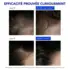 Traitement Antichute Réactionnelle Phytophanère 12 x 5 ml Phyto