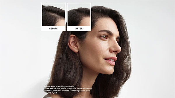 Nioxin