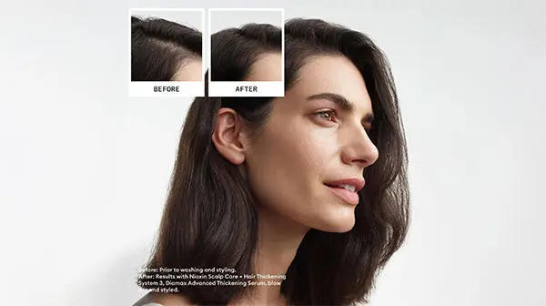 Nioxin