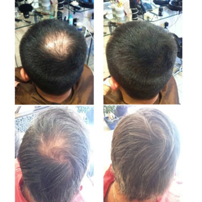 Hair 30 chatain foncé