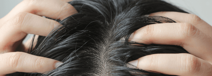 quel-shampoing-pour-les-cheveux-gras-blog-pascal-coste-cuir-chevelu_68fb7d1ba0b8f.png