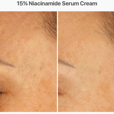Sérum Crème 15% Niacinamide Monoactives La Cabine 30ml