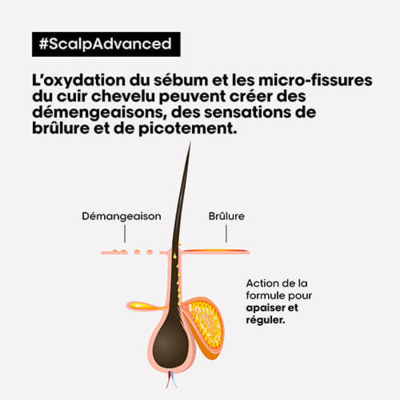 Shampooing Dermo-régulateur Apaisant Scalp Advanced L'Oréal Pro 300ml